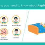 Understanding and Preventing Typhoid Fever