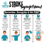Stroke Management